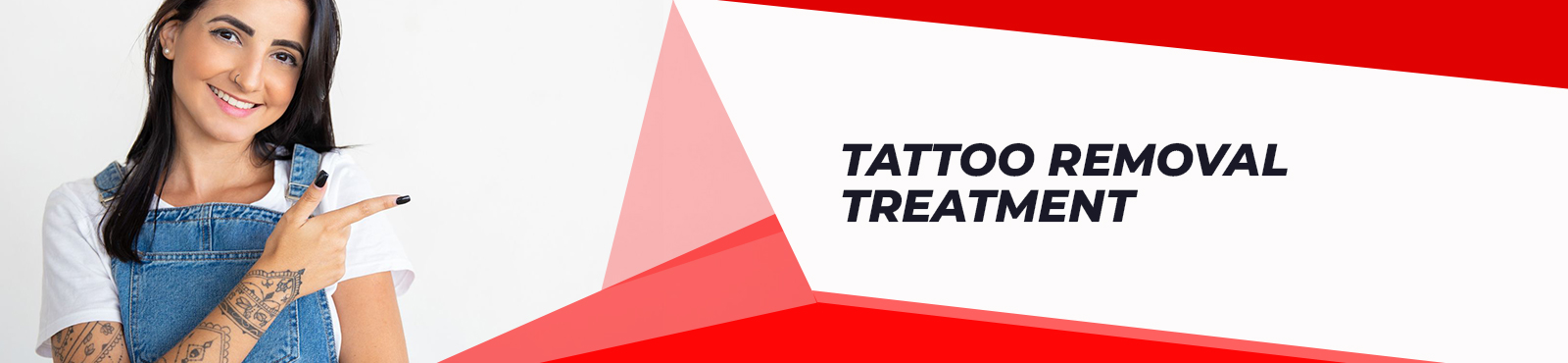 Tattoo Removal