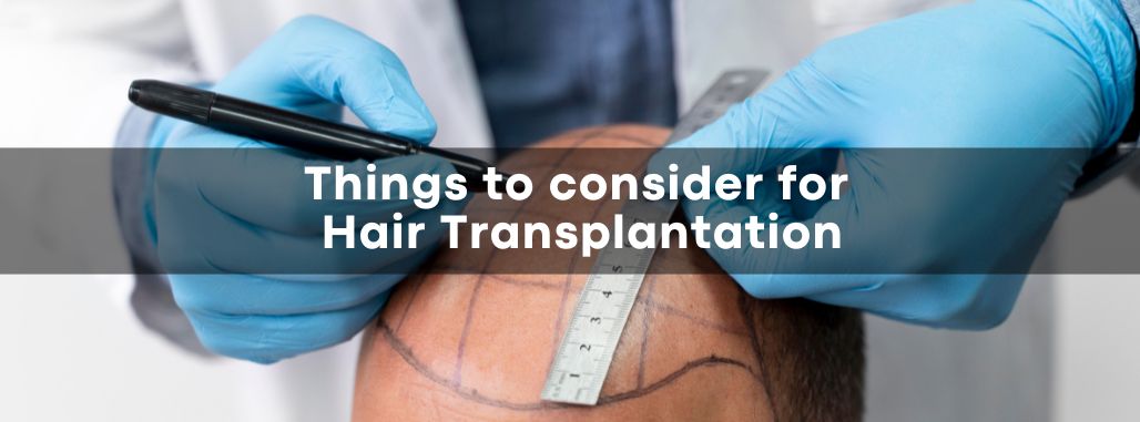 Top Considerations While Preparing for A Hair Transplant