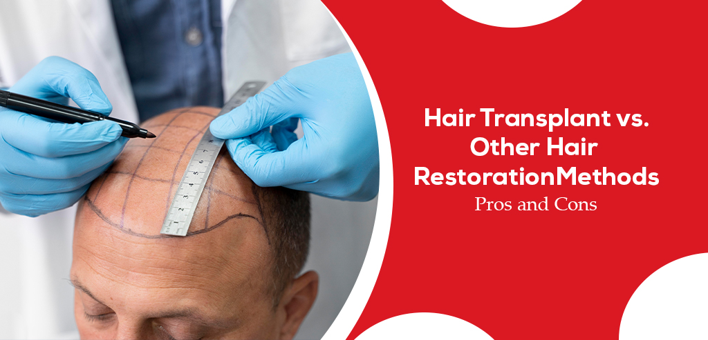 Hair Transplant vs Other Hair Restoration Methods: Pros and Cons