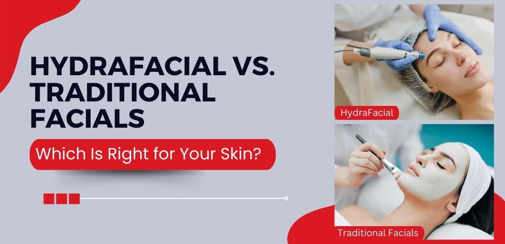 HydraFacial vs. Traditional Facials: Which Is Right for Your Skin?