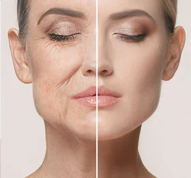 Anti Ageing Treatment