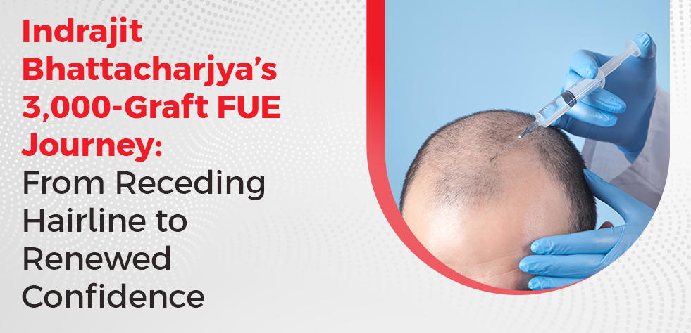 Indrajit Bhattacharjya’s 3,000-Graft FUE Journey: From Receding Hairline to Renewed Confidence