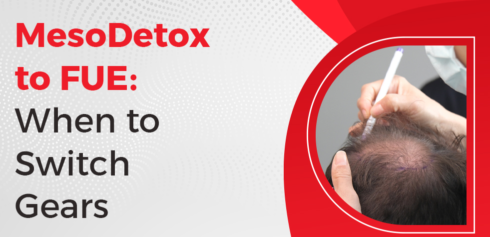 MesoDetox to FUE: When to Switch Gears