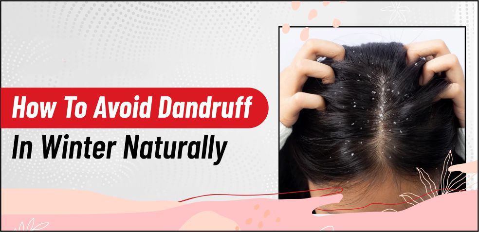 How to Avoid Dandruff in Winter Naturally: A Dermatologist’s Guide