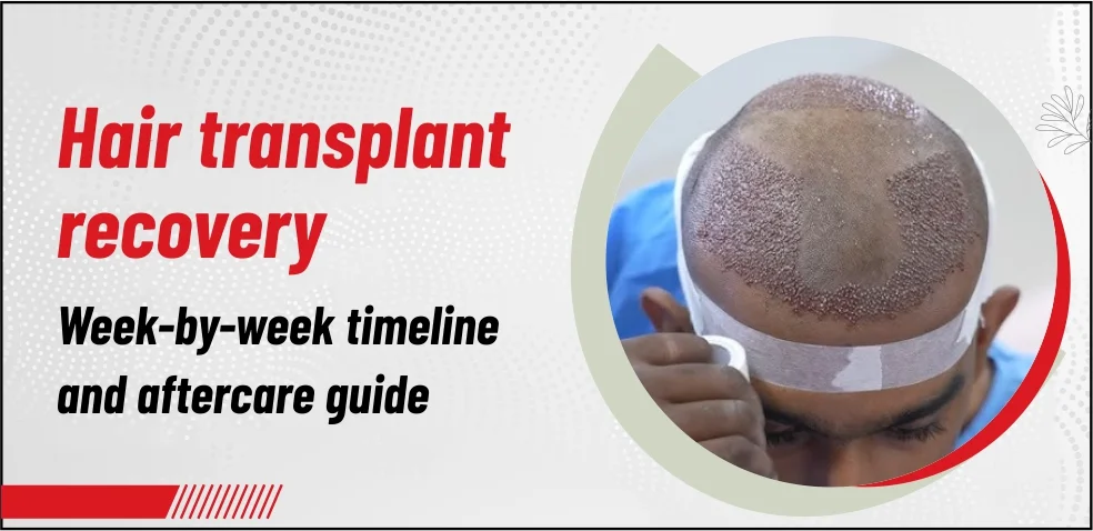 Hair Transplant Recovery – Week-by-Week Timeline, Healing Process & Aftercare Guide (2026)