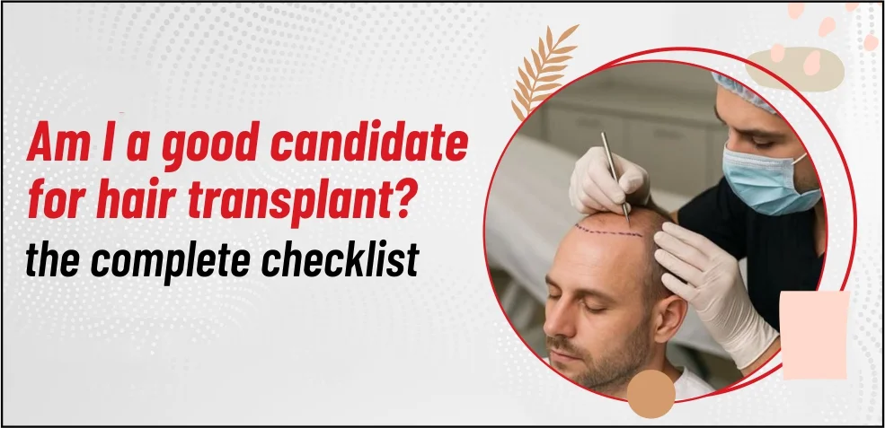 Am I a good candidate for a hair transplant? – The Complete Checklist