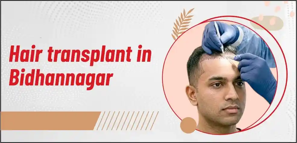 Best Hair Transplant Centre in Bidhannagar Kolkata