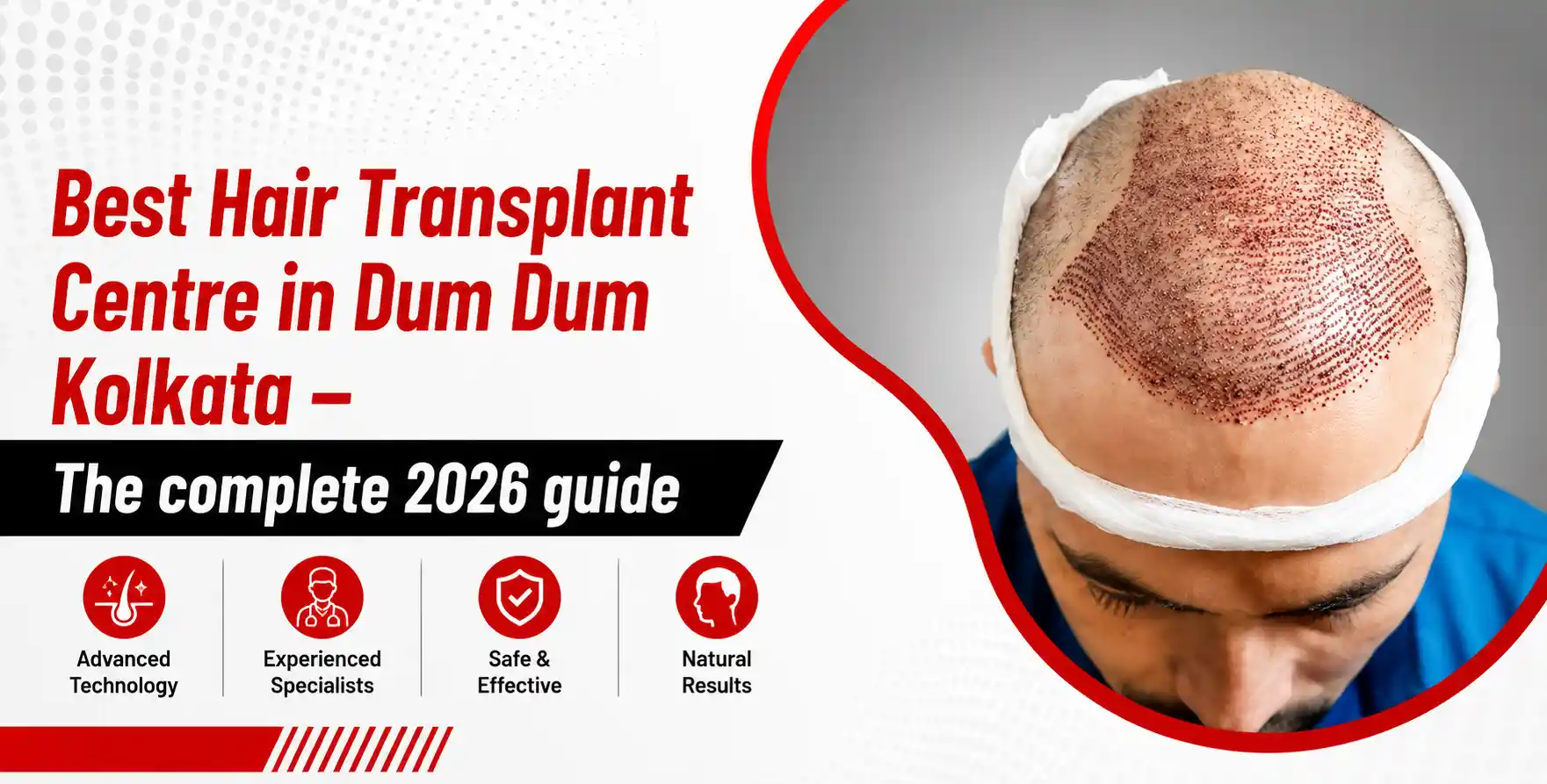 best-hair-transplant-centre-in-dum-dum
