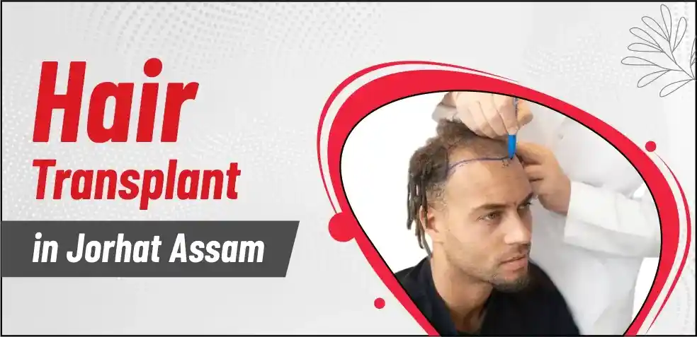 Best Hair Transplant Centre in Jorhat Assam