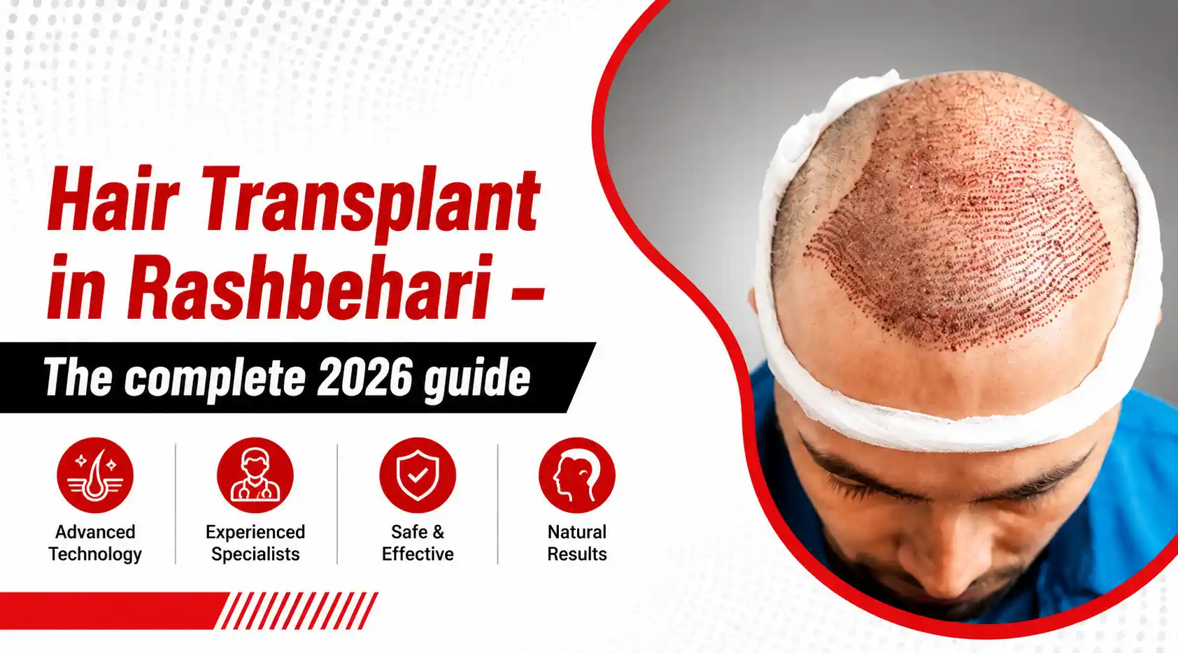 best-hair-transplant-centre-in-rashbehari