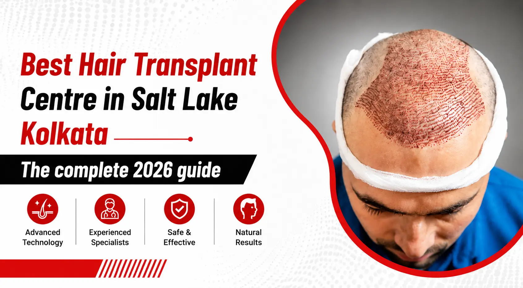 Best Hair Transplant Centre in Salt Lake Kolkata